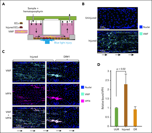 hPF4 binds to elongated strings of VWF released from injured HUVECs in a microfluidic system. (A) Schematic of the endothelialized microfluidic system used to study the effect of photochemical injury to targeted regions of the endothelium. (B) Comparison of a representative area of uninjured endothelium and the immediate upstream hematoporphyrin-injured area showing pyknotic nuclei and VWF strings only released after injury. (C) Appearance at representative injured site within the microfluidic channel and at site DR, the first 250 µ downstream of the edge of the injured site. Direction of flow is indicated by arrows. Channels were stained for PF4 using a polyclonal anti-hPF4 antibody as well as staining for nuclei and VWF. (D) Relative binding of PF4 to either 250 µ of the upstream uninjured region (UUR), the injured region, or the downstream of injury region (DR). Results are expressed as the mean ± 1 standard error of the mean (SEM) from N ≥ 4 separate microfluidic channels. P values were determined using a 1-way ANOVA analysis to compare binding to the UUR of the channel. EC, endothelial cells.