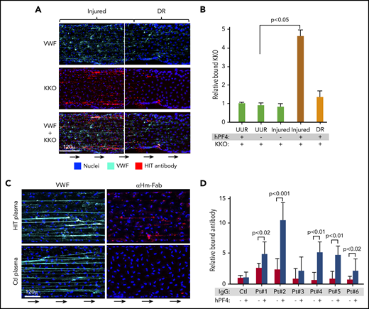 KKO and HIT patient IgGs bind to PF4-VWF complexes ex vivo. (A) Representative injured area and downstream of injury region (DR) in the microfluidic channels as in Figure 1C stained for VWF and KKO. (B) Comparison as in Figure 1D for total KKO bound relative to the UUR and DR. Means ± 1 SEM are shown for N ≥ 5 separate studies. P values were determined by a 1-way ANOVA. Panels C-D are similar to panels A-B, respectively, but show only the injured areas stained for either VWF or for anti-human Fab fragments (αHm-Fab). (C) Diluted plasma from patients at high risk of having HIT or low-risk controls (Ctl)33 were used. (D) Relative binding of IgG from the HIT or control samples (N = 6 normal controls) are shown. Means ± 1 SEM are shown from N ≥ 5 separate studies. P values were determined using a 1-way ANOVA to compare relative binding of each IgG in the absence of hPF4 vs in the presence of infused PF4 (25 µg/mL) with control samples in the absence of PF4 set to 1.