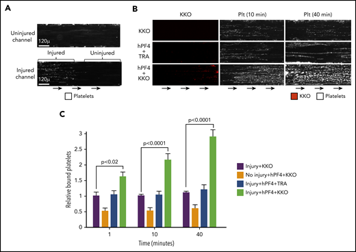 hPF4-VWF-HIT antibody complexes are prothrombotic in vitro. (A) Representative fields showing (top) uninjured and (bottom) injured endothelium as in Figure 1B, but after exposure to the flow of recalcified whole human blood for 10 minutes. Binding of platelets to the VWF strings is shown. The bottom channel shows an injured area with platelets and the immediate, contiguous uninjured downstream area resembling in appearance the uninjured top channel. (B) Same as in panel A, but with the inclusion of hPF4 (25 µg/mL) and the indicated monoclonal antibody (10 µg/mL) and studied at the time points indicated. Representative binding of labeled KKO and platelets are shown. Platelet accumulation at 10 and 40 minutes is shown. (C) Same as in panel B, but for N ≥ 5 separate studies. Means ± 1 SEM are shown. P values were determined using a 1-way ANOVA.