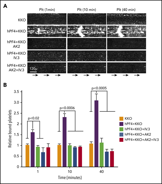 Binding of platelets to hPF4-VWF-HIT antibody complexes is dependent on both their FcγRIIA and GPIb/IX receptors. (A) As in Figure 4B, representative fields showing platelet accumulation on injured endothelium after exposure to the flow of recalcified human blood in the presence or absence of PF4 and KKO and the GPIb-IX-blocking antibody AK2 or FcγRIIA-blocking antibody IV.3 or both. (B) In each case, binding of platelets is shown relative to injured endothelium with added KKO only as the comparator. Means ± 1 SEM are shown for N ≥ 5 separate injured studies. P values were determined using a 1-way ANOVA. See supplemental Figure 5 for additional controls.