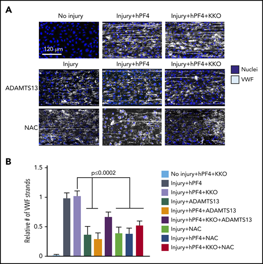 Inhibition of hPF4-VWF-HIT antibody complexes in vitro. Effect of ADAMTS13 or NAC on hPF4-VWF and hPF4-VWF-HIT antibody complexes. (A) Representative images from studies in Figure 3A after infusion of PF4 (25 µg/mL) into each lane. In some studies, KKO (10 µg/mL), ADAMTS13 (0.7 µg/mL), and/or NAC (10 mg/mL) was added as indicated. (B) The number of VWF strings present in the channel after exposure to the indicated solution is expressed relative to those present in channels following injury and exposure to hPF4 + KKO alone. Means ± 1 SEM are shown for N ≥ 5 studies. P values were determined by 1-way ANOVA.