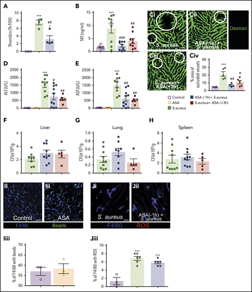 ASA treatment reduces infection-induced coagulopathy but did not affect pathogen clearance. (A) Quantitative analysis of thrombin probe fluorescence within the liver microcirculation of control mice, S aureus–treated mice, or S aureus–treated mice that received ASA 1 hour prior infection (N = 3-4). Values represent the percentage of an FOV occupied by the fluorescent probe. (B) TAT complex plasma levels in control mice, S aureus–infected mice, and mice treated with ASA 1 hour prior to, or 3 hours after, infection (N = 7-9). (C) Mice were injected with fluorescein isothiocyanate–dextran as a contrast agent to identify perfused liver vasculature in S aureus–infected mice (i), in S aureus–infected mice pretreated with ASA (ii), or mice treated with ASA 3 hours after infection (iii). (iv) Quantification of the percentage of an FOV occupied by occluded vessels (N = 4-5). Liver vasculature was stained by IV injection of fluorescently-conjugated dextran (green); scale bar, 50 μm. (D-H) ALT (D) and AST (E) were quantified in plasma of control and S aureus–infected mice with and without ASA treatment (N = 3-10). After 6 hours of infection, the liver (F), lungs (G), and spleen (H) were collected and bacterial CFUs were measured in infected and ASA-treated mice (N = 5-10). Values are presented as the number of CFUs per gram of tissue. (I) Representative images of sterile bead capture from the circulation by KCs in control (i) and ASA-treated mice (ii) (N = 3). Quantification of bead capture by KCs in control and ASA-treated mice (iii). (J) Representative images of ROS production by KCs in control infected (i) and ASA-pretreated mice infected with S aureus (ii). Quantification of ROS+ KCs in infected control and ASA-treated mice (iii) (N = 3-6). (I-J) Labelling of cells in vivo was achieved by IV injection of fluorescently-conjugated antibodies against F4/80 (Kupffer cells; blue). Flurescent polystyrene beads were injected IV (green) in panel I whereas dihydroethidium was injected IV in panel J. Dihydroethidium is converted to a precipitant in the presence of ROS (red); scale bar, 50 μm. Values represent the percentage of KCs per FOV that stain positive for ROS production. Values represent the mean obtained from at least 5 FOVs in each animal. Data are represented as mean plus or minus SEM. Statistical analysis was conduced using a 1-way ANOVA with a post hoc Tukey test for panels A-B, Civ, D-H, and Jiii and a Student t test for Iiii. ***P < .001 vs control; #P < .05, ##P < .01, ###P < .001 vs S aureus.