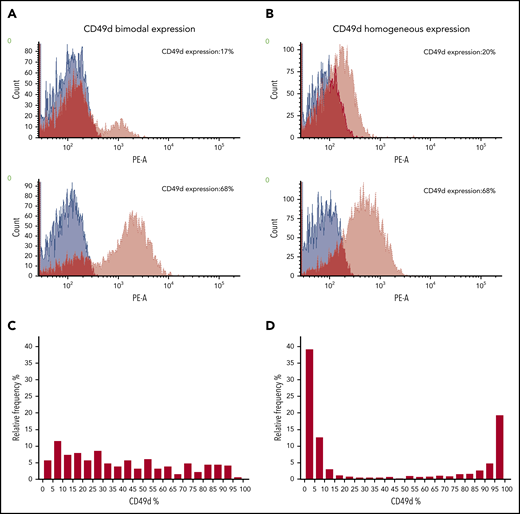 CD49d bimodal and homogeneous expression. (A-B) Histogram plots of CD49d expression (red) in 2 representative CLL cases with CD49d bimodal expression (A) and in 2 representative CLL cases with CD49d homogeneous expression (B). Blue histograms refer to unstained cells. The dark red color corresponds to the overlap of CD49d and unstained histogram plots. (C-D) Relative percentage of frequency of CD49d expression in CLL with CD49d bimodal (C) and CD49d homogeneous (D) expression.