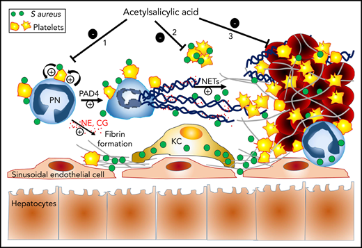 Proposed mechanisms of the protective action of ASA against S aureus sepsis-induced hepatic thrombosis. Once in the blood, circulating S aureus triggers an immunothrombotic cascade resulting in intravascular coagulation and occlusion of liver sinusoids. Circulating S aureus activates neutrophils and platelets through direct physical interactions (eg, via toll-like receptors and other pattern-recognition receptors) and secretion of immunomodulatory proteins, thus stimulating neutrophil-platelet reciprocal activating interactions. These interactions lead to the release of neutrophil elastase (NE) and cathepsin-G (CG) by neutrophils (PN), as well as to PAD4-dependent formation of procoagulant NETs. Together with nucleosomes, free and NETs-associated NE and CG enhance tissue factor- and factor XII-dependent coagulation, by degrading the tissue factor pathway inhibitor. Intravascular fibrin deposits and NETs help to capture and kill circulating S aureus, while at the same time, they promote liver injury and dysfunction by occluding sinusoids. Depending on the timing of administration, treatment with ASA can prevent thrombosis in sinusoids and associated liver injury by acting on at least 3 possible levels: (1) prevention of NETosis through inhibition of neutrophil-platelet interactions and reciprocal activation, (2) inhibition of S aureus–induced platelet aggregation, and (3) inhibition of platelet incorporation and aggregation on preformed prothrombotic NETs. The antibacterial action of “non-NETotic” neutrophils and other immune cells like Kupffer cells (KC) helps minimize the impact of ASA treatment on bacterial elimination.
