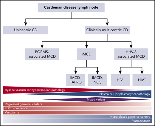 Classification of CD. Triangles and diamond represent the relative frequency that each of these pathologies occurs within the different subtypes of CD. The relative red and blue shading reflects the extent to which each of the pathology types contains either hypervascular or plasmacytic pathology. FDC, follicular dendritic cell. Adapted from Fajgenbaum et al.11