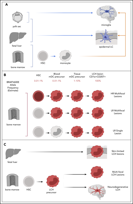 Models of LCH pathogenesis. (A) Ontogeny of physiologic epidermal LCs and microglia may inform mechanisms of LCH pathogenesis. Physiologic epidermal LCs arise from yolk sac and fetal liver; microglia arise from yolk sac (blue arrows). Subsequently, epidermal LC and microglia may be replace monocytes derived from bone marrow after activation or injury (orange arrows). (B) The variant allele frequency (BRAFV600E or other MAPK mutation) is found in very rare population in myeloid precursors in bone marrow and peripheral blood in patients with HR LCH and some with LR multifocal LCH. The Misguided Model of LCH Pathogenesis proposes that extent of disease is defined by the state of differentiation at which an activating somatic MAPK pathway gene mutation arises (red). (C) Lack of detectable PBMCs with BRAFV600E and self-resolving course support potential fetal liver origin, where identification of PBMCs with BRAFV600E and perivascular BRAF-V600E+ cells at sites of neurodegeneration support potential for hematopoietic clone (red) in LCH-ND. HSC, hematopoietic stem cell; HR, high risk; LR, low risk; mDC, myeloid dendritic cell.