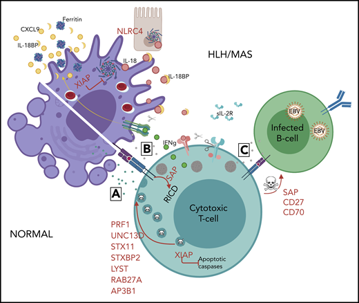 Mechanisms of genetic HLH predisposition. HLH is thought to develop due to abnormal reciprocal activation of mononuclear phagocytes (MNPs; monocytes, macrophages, and dendritic cells) and type 1 lymphocytes (NK cells and Th1, CD8, and NKT cells). T cells with normal cytotoxic granules release them to induce MNP apoptosis and terminate the synapse, whereas impaired or perforin-deficient granules (gray) cannot terminate MNP activation. Immune synapse prolongation and excess IL-18 (from MNP and/or epithelial sources) both amplify production of lymphocyte cytokines like IFN-γ, which in turn further activates MNPs and promotes hemophagocytosis and release of HLH biomarkers like ferritin, CXCL9, and IL-18BP. Activated lymphocytes upregulate the IL-2 receptor, which is cleaved by proteases released by activated MNPs. The absence of XIAP may permit pathogenic inflammasome activation and lymphocyte apoptosis, while SAP deficiency impairs restimulation-induced cell death (RICD) and, like CD27 and CD70 deficiency, prevents normal killing of EBV-infected B cells.