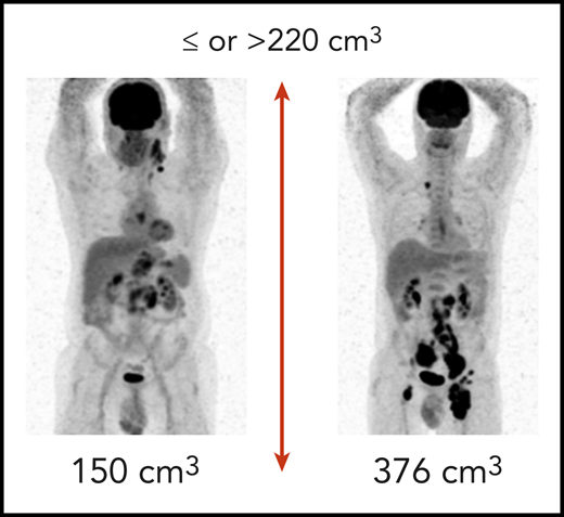 Examples of patients from the REMARC trial with low and high total metabolic tumor volume. (Courtesy of M. Meignan and C. Thieblemont.)