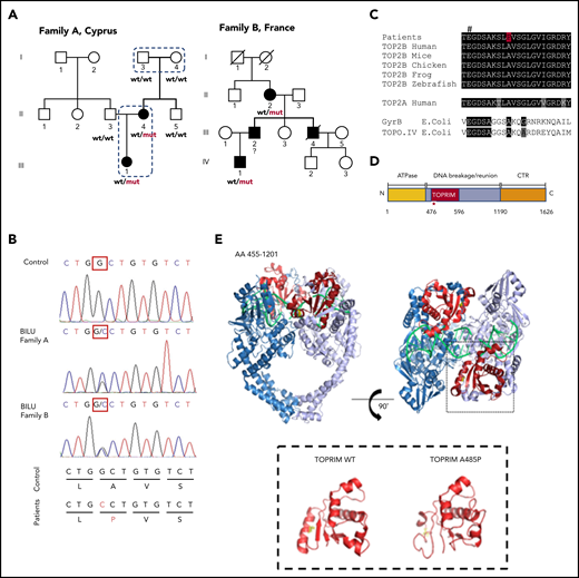 Novel dominant mutation A485P affects TOP2B catalytic site and causes the BILU syndrome. (A) Two families with the BILU syndrome: ○ and □, unaffected; ● and ▪, affected; wt, wild-type allele; mut, A485P mutation in TOP2B. Exome sequencing was performed in 4 subjects, shown by dotted lines. (B) Electrophoregrams of the TOP2B genomic DNA sequence showing the same mutation in patients from the 2 BILU families. (C) Multispecies protein sequence alignment of type II topoisomerases. #Conserved glutamate essential for TOP2B activity. (D) Schematic representation of domains of the TOP2B protein. The A485P mutation in the TOPRIM domain is shown by a red star. The TOPRIM domain is part of the DNA gate that catalyzes DNA cleavage and religation. (E) Structure of the TOP2B homodimer (amino acid residues 455 to 1201) in complex with DNA (green), the TOPRIM domain (red), and the alanine at codon 485 (yellow; upper). I-TASSER-modeled structures25 of the TOP2B TOPRIM domain (lower).