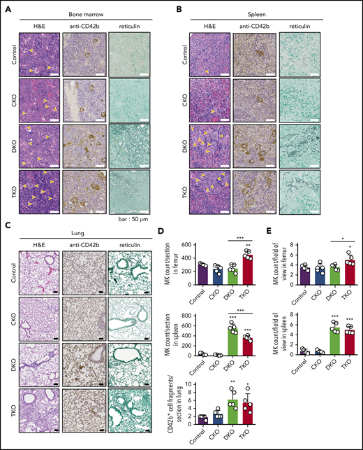 Aberrant megakaryocyte counts and myelofibrosis in DKO and TKO mice. Histological sections of mouse bone marrow (A), spleen (B), and lung (C) of the indicated genotypes stained with hematoxylin and eosin (H&E), the megakaryocytic marker CD42b, or reticulin. MKs are highlighted by yellow arrows. (D) Total number of MKs per section in the indicated organs, n = 5 mice/genotype. (E) MK numbers per field of view in the indicated organs, n = 5 mice/genotype (mean of 15 fields/mouse). Analysis of MK numbers was performed in a double-blinded manner. *P < .05, **P < .01, ***P < .001, 1-way ANOVA with Sidak test; mean ± SD.