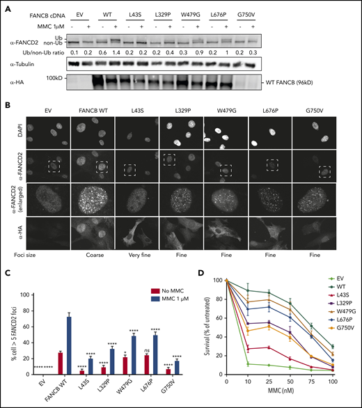 Overexpression of missense variants in FANCB-null fibroblasts show varying degree of residual function. hemagglutinin (HA)-tagged complementary DNA of FANCB WT or 5 missense variants were overexpressed by lentiviral vector in FANCB-null fibroblasts, followed by functional analysis. (A) Western blot of FANCD2, tubulin, and HA-FANCB. Near-normal FANCD2 ubiquitination was observed upon mitomycin C (MMC) exposure in cells expressing p.W479G and p.L676P, whereas cells expressing p.L43S showed almost no FANCD2 ubiquitination. Expression of p.L329P and p.G750V resulted in low level of FANCD2 ubiquitination. HA-FANCB p.G750V was unstable. Tubulin was used as loading control. Relative ratio of ubiquitinated FANCD2 band to nonubiquitinated FANCD band was measured for each variant. (B) Immunofluorescence of FANCD2 and HA-FANCB. Cells expressing HA-FANCB missense variants displayed smaller and fewer FANCD2 foci than cells expressing WT FANCD2 (original magnification ×630 oil immersion). (C) Quantification of FANCD2 foci–positive cells. One hundred cells were counted in triplicate per each experiment. Three independent experiments were performed. Statistical analysis was performed using one-way analysis of variance followed by Dunnett’s multiple comparison test. (D) Fibroblasts expressing FANCB WT or missense variants were treated with corresponding doses of MMC. Surviving cells were counted, and survival was calculated relative to untreated cells. Three independent experiments were performed. A graph from a representative experiment is shown. *P < .05, ****P < .001. DAPI, 4′,6-diamidino-2-phenylindole; EV, empty vector; ns, not significant.
