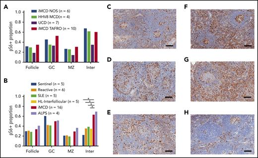 Comparison of pS6 staining across CD subtypes and other lymphoproliferative diseases. (A) pS6 across different CD subtypes. A second cohort of iMCD-TAFRO patients (cohort 2, n = 10) was compared with iMCD-NOS (n = 6), HHV-8–associated MCD (HHV8 MCD, n = 4), and UCD (n = 7). The proportion of pS6 staining was similar across both clinical subtypes of iMCD as well as HHV-8–associated MCD. Comparison between the combined iMCD cases (n = 16) and the UCD cases (n = 4) showed nonsignificant increase in pS6-staining of the germinal center (P = .17), mantle zone (P = .065), and interfollicular space (P = .089). Of note, a 1-tailed test comparing expression in the interfollicular space of iMCD to UCD would have been significant, but the a priori hypothesis involved testing for difference, not directional difference. (B) The second cohort of iMCD-TAFRO patients and the iMCD-NOS cases were combined and compared with a control group of sentinel lymph nodes, a second control group of reactive lymph nodes, and to 3 other diseases involving lymphoproliferation and inflammatory lymphadenopathy: SLE, HL, and ALPS. pS6 could only be assessed in the interfollicular space of the HL cases due to disruption of the remainder of lymph node architecture. ALPS and iMCD had similar pS6 staining; the iMCD group had significantly higher staining in the interfollicular space compared with SLE, HL, reactive nodes, and sentinel nodes (P = .001, .01, .032, and .019, respectively). (C-H) Representative images of pS6-stained (brown) lymph node tissue (with blue hematoxylin counterstain) for (C) reactive lymph nodes, (D) SLE, (E) HL, (F) iMCD-TAFRO, (G) ALPS, and (H) UCD. Scale bars, 200 µm. *P < .05, **P < .01.