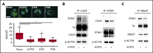 CALR-STIM1 binding is impaired in presence of CALR type I mutation. (A) Top, In situ PLA imaging of STIM1 and CALR interaction (green dots) in CB-derived mature Mks starved (None) or treated with 100 ng/mL rhTPO, 10 μM CPA, or 1 U/mL thrombin (THR). Nuclei are visualized with Hoechst 33258 (blue). Scale bar, 10 μm. Original magnification, ×60/NA1.2. Bottom, Quantification of dot number per single Mk (overall, data derive from 92 measurements; P < .05). (B) CB-derived Mks were treated (+) or not (−) for 10 minutes with rhTPO (100 ng/mL) and lysed. Lysates were immunoprecipitated (IP) with an anti-CALR or anti-STIM1 antibody and subjected to western blotting. Membranes were stained with antibodies against STIM1 and CALR, respectively, and reblotted with the same antibodies to ensure equal immunoprecipitation of the proteins of interest. (C) CB-derived Mks were treated (+) or not (−) for 10 minutes with rhTPO (100 ng/mL) and lysed. Lysates were immunoprecipitated with an anti-ERp57 antibody and subjected to western blotting. Membrane was stained with an antibody against STIM1 and reblotted with anti-ERp57 antibody to ensure equal immunoprecipitation of the protein. β-ACTIN was used as input control.