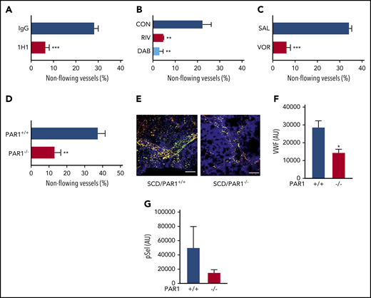 Inhibition of TF-dependent proteases and PAR-1 prevents heme-induced stasis in sickle mice. In sickle mice implanted with dorsal skinfold chambers, flowing venules were selected and mapped at baseline (20-25 venules per mouse). Mice were given a bolus infusion of stroma-free hemoglobin (SFH; 1.6 µmol/kg, IV). Percentage stasis was measured using intravital microscopy 1 hour after infusion. (A) NY1DD sickle mice were treated with control immunoglobulin G or anti-TF antibody 1H1 (25 mg/kg, intraperitoneally) 30 minutes prior to induction of stasis. (B) NY1DD mice received control chow, dabigatran (10 mg/g chow), or rivaroxaban (0.4 mg/g chow) for 4 days prior to induction of stasis. (C) NY1DD mice received saline or vorapaxar (150 µg/kg, oral gavage) once a day for 3 days prior to stasis experiments. (D) SCD/PAR1+/+ or SCD/PAR1−/− mice were infused with SFH 4 months after bone marrow transplantation. (E) The lungs of SCD/PAR1+/+ and SCD/PAR1−/− mice were excised after SFH infusion, fixed in 4% paraformaldehyde, and stained for surface pSel (green), VWF (red), and CD31 (blue). Costaining of green and red is shown as yellow. Quantification of positive pixels of VWF (scale bars, 30 μm) (F) and pSel (G) staining is represented as arbitrary units and was performed as described.9 Data are represented as mean percentage stasis + standard deviation, n = 3 to 5 mice per group. *P < .05, **P < .01, ***P < .001, 2-tailed, unpaired Student t test or 1-way analysis of variance, as appropriate.