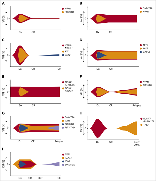 Illustrations of dynamic patterns of the mutational landscape after therapy for AML. (A) gMRD. At diagnosis (Dx), FLT3-ITD and NPM1 mutations were present. In CR, there is detectable NPM1 mutation, indicating the presence of gMRD despite morphologic CR. (B) CH that was detectable in the original AML. At diagnosis, DNMT3A and NPM1 mutations were present, both at high VAFs. In CR, there is no detectable NPM1 mutation, but a persistent DNMT3A mutation, indicating the presence of CH shared with the AML clone. If absence of NPM1 mutation is confirmed by a sensitive method, this would represent CH without gMRD. (C) CH that was not detected in the original AML. At diagnosis, CBFB-MYH11 rearrangement and KIT mutations were present, which disappeared in the initial CR time points. Subsequently, a TET2 mutation developed, indicating CH that was either present at a very low level prior to treatment (presumably not in the AML clone) or emerged after therapy. (D) RMN. At diagnosis, JAK2, TET2, and GATA2 mutations were present. The JAK2 and TET2 mutations persist in CR and BM shows morphologic features of primary myelofibrosis, indicating RMN despite morphologic CR and disappearance of the GATA2 mutation (which is likely AML-related in this case). (E) Persistent germline mutation. At diagnosis, 2 DDX41 mutations were present, 1 of which was shown to be of germline origin. After treatment in CR, the germline DDX41 mutation persists, with a similar VAF at all time points. (F) Recurrent AML. At diagnosis, NPM1 and FLT3-ITD mutations were present, which disappeared in CR. The same NPM1 and FLT3-ITD mutations are present at the time of relapse. (G) Recurrent AML with AML-related CH-type mutations, but new AML-related mutation. At diagnosis, DNMT3A, IDH1, and FLT3-ITD mutations were present, with persistence of the DNMT3A and IDH1 mutations during CR. At relapse, a new FLT3-TKD mutation has been acquired; nevertheless, the shared unique DNMT3A and IDH1 mutations indicate recurrence of the original clone rather than a new, unrelated clone. (H) New clonally unrelated AML. At diagnosis, RUNX1-RUNX1T1 rearrangement was present, which disappeared in CR. At relapse, there is a new TP53 mutation and a complex karyotype, but no RUNX1-RUNX1T1 rearrangement, indicating a new genetically distinct AML that is considered to be therapy-related. (I) Donor-derived CHIP. At diagnosis, TET2, ASXL1, and IDH2 mutation were present. Following HCT from an unrelated donor, the TET2, ASXL1, and IDH2 mutations disappear and the patient remains in CR, but a new DNMT3A mutation has appeared that was absent in the original leukemia. Chimerism studies show 100% donor chimerism, indicating DNMT3A-mutated CHIP that is donor derived (rather than originating from a low-level undetectable mutation that was present in the original recipient AML).