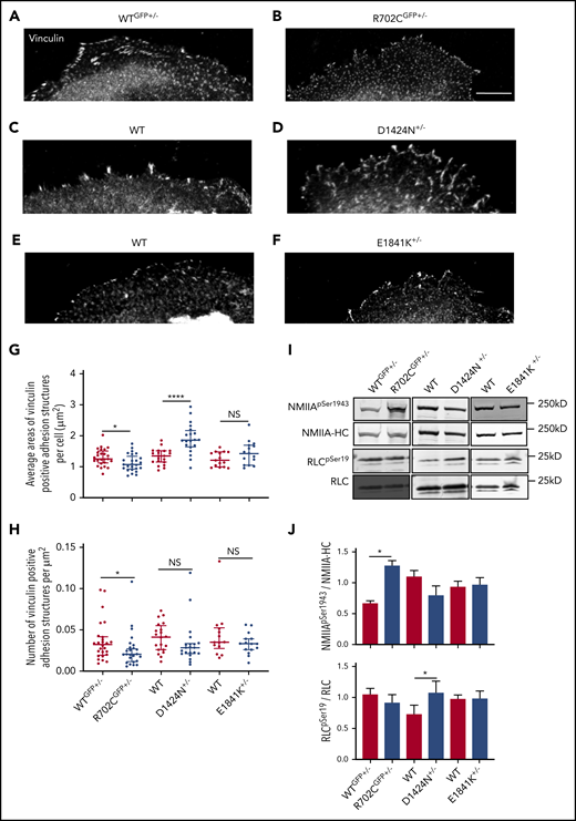Motor and rod domain mutations associated with Myh9-RD differentially affect cell adhesion and NMIIA functions. (A-F) Vinculin staining of MKs spread on collagen-1 coverslips. Scale bar, 25μm. Images were acquired with a Plan-Fluor ×63 objective (N.A. 1.4) of a Zeiss LSM 780 confocal microscope with Zeiss AxioCam. Images were processed with ZEN software available from Zeiss. Analysis of vinculin-positive focal adhesion sites were performed with ImageJ. (G) Scatterplots representing median and interquartile range of the distribution for areas of vinculin-positive structures in WT and Myh9-RD mice MKs. (H) Scatterplots representing median and interquartile range of the distribution for vinculin-positive sites per unit area in MKs from Myh9-RD and WT littermate control mice (WTGFP+/−, n = 25; R702CGFP+/−, n = 25; WT, n = 20; D1424N+/−, n = 20; WT, n = 15; E1841K+/−, n = 15). (I) Representative immunoblots showing phosphorylated RLC (RLCSer19) and total RLC levels or showing phosphorylated myosin HC (NMIIASer1943) and total NMIIA-HC levels in WT and mutant MKs. (J) Graph represents quantification of immunoblots as mean ± standard error of the mean from ≥3 experiments
