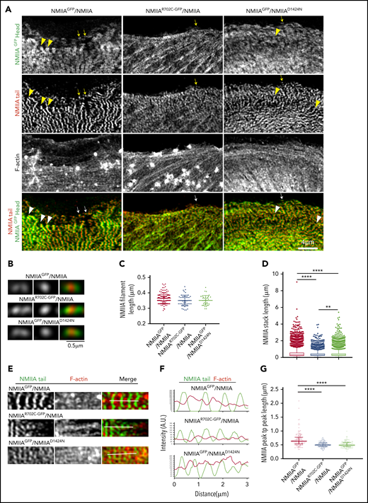 NMIIA mutations associated with Myh9-RDs alter stack assembly on actin stress fibers without affecting bipolar filament formation in MKs. (A) Confocal Airyscan images of NMIIA head, NMIIA tail, and F-actin in MKs spread on collagen I. Arrowheads indicate NMIIA stacks, and arrows indicate NMIIA bipolar filaments, which have been presented as zoomed images in panel B. Scale bars, 4 μm (A) and 0.5 μm (B). (C) Scatterplot showing the median and interquartile range of the distribution for bipolar filament lengths in WT and Myh9-RD mutant MKs (NMIIAGFP/NMIIA, n = 120; NMIIAR702C-GFP/NMIIA, n = 50; NMIIAGFP/NMIIAD1424N, n = 35). (D) Box and whisker plots representing the distribution of the lengths of NMIIA stacks (NMIIAGFP/NMIIA, n = 8614; NMIIAR702C-GFP/NMIIA; n = 5348; NMIIAGFP/NMIIAD1424N, n = 7360). (E) Representative confocal Airyscan images and (F) fluorescence intensity plots indicating the line scans used for graphical analysis of the arrangement of NMIIA filaments on actin stress fibers. (G) Scatterplots representing the median and interquartile range of the distribution for distance between 2 successive NMIIA filaments on actin stress fibers (NMIIAGFP/NMIIA, n = 142; NMIIAR702C-GFP/NMIIA, n = 142; NMIIAGFP/NMIIAD1424N, n = 144). Images were acquired with either a Plan-Apochromat ×63 or ×100 objective (NA, 1.46) of a Zeiss LSM 880 confocal Airyscan microscope with Zeiss AxioCam. Images were processed with ZEN software and quantifications were performed with Nikon Elements 5.1. **P ≤ .01; ***P ≤ .001; ****P ≤ .0001.