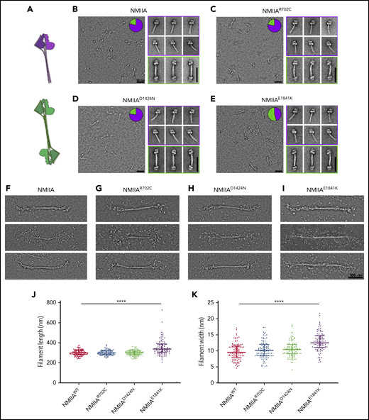 E1841K strengthens antiparallel interactions and results in overassembly of filaments in vitro. (A) Diagram depicting NMIIA folded monomer conformation and antiparallel association state. (B-E) Electron micrographs of WT and mutant NMIIA molecules in the disassembled state. Inset pie charts indicate the proportion of molecules in the folded monomer or antiparallel dimer state. Representative class averages of each type are shown alongside. Scale bars, 50 nm. (F-I) Representative electron micrographs of NMIIA bipolar filaments in the assembled state. Scale bar, 100 nm. Scatterplot representing median and interquartile range of filament length (J) and filament width (K). n = 100 filaments for each sample. Image acquisitions were performed with JEOL 1200EX electron microscope equipped with an AMT XR-60 CCD camera. Image alignments were done with SPIDER software, and quantifications were done with Fiji.