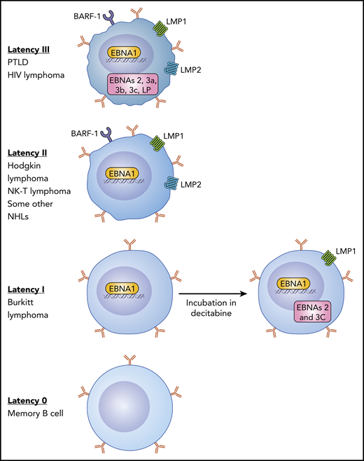 There are 4 EBV latency states in B cells. Type III latency is the most immunogenic with expression of all of the latency-associated proteins that induce B-cell transformation and is seen in lymphomas that arise in individuals with profound immunosuppression such as PTLD. Type II latency tumors that include some cases of Hodgkin lymphoma and some NHLs express EBNA1, LMP1, and LMP2 and have intermediate immunogenicity. BL expresses type I latency with only EBNA1 expressed and is poorly susceptible to an EBV-CTL response. In type 0 latency, seen in normal memory B cells, no viral genes are expressed. Dalton et al show that incubation of type I latency lymphoma cells with decitabine can result in upregulation of the LMP1 and EBNA2 genes, making these cells more susceptible to EBV-CTLs. NK-T, natural killer T cell.
