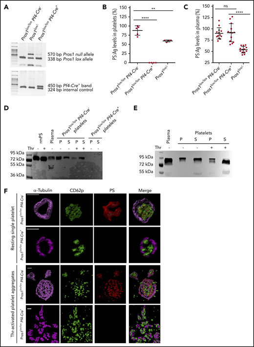 Generation of a mouse model lacking PS expression in platelets (Pros1lox/loxPf4-Cre+). (A) Genotyping results of mice with normal PS expression (Pros1lox/loxPf4-Cre−), Pros1lox/−, and Pros1lox/loxPf4-Cre+ mice using genomic DNA extracted from ear tissues. The presence of lox sequences in Pros1 alleles and of Pf4-Cre transgene was evaluated by 2 independent multiplex PCRs. PCR products were then subjected to electrophoresis. The lox band had a lower molecular weight (338 bp) compared with the null band (570 bp), in accordance with Saller et al25; the Pf4-Cre+ band has a higher molecular weight (450 bp) in comparison with the internal PCR control (324 bp). (B) PS antigen levels in platelet lysates from Pros1lox/loxPf4-Cre−, Pros1lox/loxPf4-Cre+, and Pros1lox/− mice. Results are expressed as mean ± standard error of the mean (SEM) of percentage relative to the pooled normal platelet lysate. **P ≤ .01; ****P ≤ .0001. (C) PS antigen levels in plasma samples from Pros1lox/loxPf4-Cre−, Pros1lox/loxPf4-Cre+, and Pros1lox/− mice. Results are expressed as mean ± SEM of percentage relative to the pooled normal plasma. ns, not significant; ****P ≤ .0001. (D-E) PS isoforms in plasma and platelet after activation by thrombin. Western blotting after sodium dodecyl sulfate-polyacrylamide gel electrophoresis under reducing conditions was performed using a monoclonal antibody raised against murine PS (D) and a polyclonal antibody against human PS (E). P, platelet; S, platelet releasate; Thr, thrombin. (F) Confocal microscopy of resting and thrombin-activated mouse Pros1lox/loxPf4-Cre− and Pros1lox/loxPf4-Cre+ platelets, stained for -tubulin (in magenta), CD62p (in green), and PS (in red). Scale bar, 2 μm. Acquired z stacks were used for volumes and surface rendering by Imaris software.