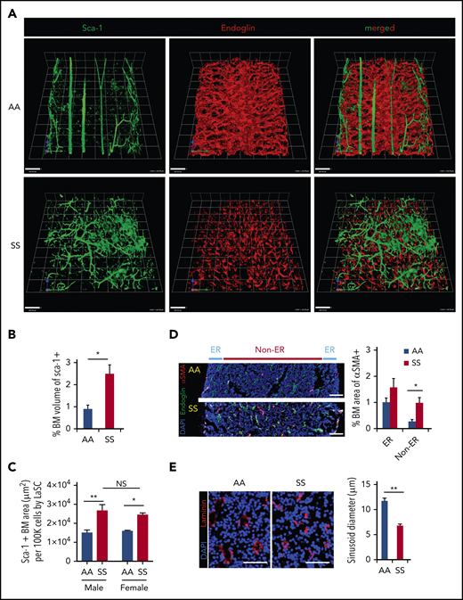 SCD mice show distinctly abnormal and disorganized BM vasculature. (A) Representative 3D reconstructed images of femoral diaphyses from healthy control (AA) and SCD (SS) mice. High-resolution whole-mount confocal images were acquired using a Leica SP8X confocal microscope after staining femurs with artery/arteriole marker Sca-1 and sinusoid marker endoglin. Arteries (Sca-1hi large vessels), arterioles (Sca-1hi small vessels), and sinusoids (endoglin+) are identified based on markers and vessel sizes. Scale bars, 100 μm. (B) Quantification of the percentage of BM volume of segmented Sca-1+ arterioles/arteries was performed using Volocity (PerkinElmer) from 3D reconstructed confocal images, as shown in (A). Percentage of BM volume of Sca-1+ = total volume of Sca-1+/total BM volume × 100; n = 4 mice per group (11-13 weeks old; 2 female mice and 2 male mice). *P < .05, 2-tailed unpaired Student t test. (C) Quantification of Sca-1+ BM area from 2D LaSC images was performed using iCys software (CompuCyte), as shown in supplemental Figure 1A. Sca-1+ BM area (μm2) per 100 000 BM cells = (Sca-1+ event number) × (mean area of Sca-1+ events)/(DAPI+ cell number) × 100 000; n = 4 mice per group (9-16 weeks old). A comparison between male and female SS mice does not show a significant difference. *P < .05, **P < .01, 2-way analysis of variance with Tukey’s multiple-comparisons test. (D) Frozen thin sections (5 μm thickness) of SCD mouse femurs were stained with antibodies against α smooth muscle actin (αSMA) and endoglin, followed by nuclear dye DAPI staining. Neovascularized arterioles were identified by αSMA+ arteriolar pericytes and quantitated by LaSC in the diaphysis of SCD mouse bones costained with endoglin. BM medullary area is divided by endosteal region (ER; BM zone within 100 μm from the endosteal surface) and non-ER. Percentage of BM area of αSMA+ = total area of αSMA+/total BM area × 100, n = 4 mice per group (11-15 weeks old; 2 female mice and 2 male mice). *P < .05, Two-tailed unpaired Student t test with Bonferroni correction for multiple comparisons. Scale bars, 100 μm. (E) The sizes of sinusoid lumens were quantitated by 2D LaSC (iCys by CompuCyte) analysis with laminin marker; n = 4 mice per group (13-15 weeks old; 2 female mice and 2 male mice). Scale bars, 50 μm. All bar graphs show mean + standard error of the mean. **P < .01, 2-tailed unpaired Student t test. NS, not significant.