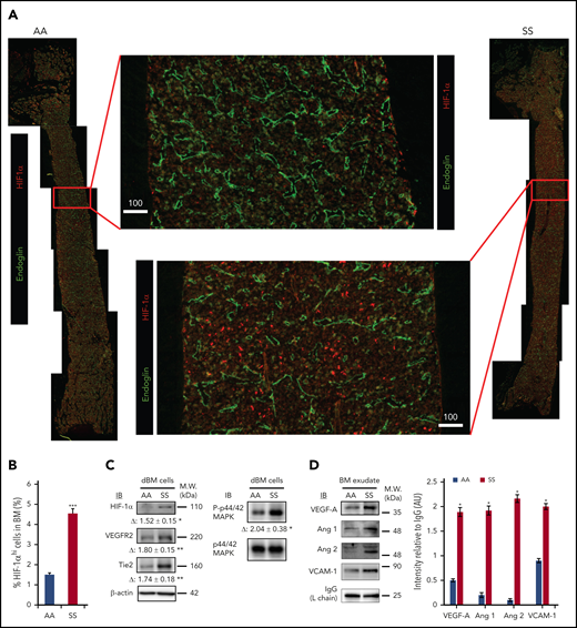 Hypoxia-induced signaling for neovasculogenesis is highly enhanced in SCD mouse BM. (A) Representative 2D images of femoral diaphyses from AA and SS mice created using LaSC. Whole-femoral sections of 12-week-old AA or SS mice were stained with endoglin and HIF-1α, followed by LaSC analysis. Scale bars, 100 μm. (B) DAPI+ HIF-1αhi cells were quantitated by LaSC. The bar graph shows the percentage of HIF-1αhi cells in the BM as mean + standard error of the mean (SEM), n = 4 mice per group (12-15 weeks old; 2 female mice and 2 male mice). (C) Hypoxia-induced signaling was analyzed by western blot, followed by densitometric analysis in the digested BM (dBM) cells from hindlimbs. The proteins in the BM exudates or cell lysates were resolved by 4% to 12% sodium dodecyl sulfate polyacrylamide gel electrophoresis gels, followed by immunoblotting with specific antibodies, as indicated, and β-actin antibody for loading controls. Representative blots are shown. Fold change (Δ) in band intensity of proteins and p44/42 MAPK phosphorylation were normalized to β-actin and p44/42 MAPK protein loading, respectively, and shown as mean ± SEM (n = 4 each; 12-15 weeks old; 2 female mice and 2 male mice). (D) Immunoblot (IB) analysis with specific antibodies against VEGF-A, Ang 1, Ang 2, and VCAM-1 of BM exudates from AA and SS mice (left panel). Immunoglobulin G (IgG) light chain (L chain) was used as a loading control. One representative gel of 6 with similar results is presented. Densitometric analysis of immunoblots is shown as a bar graph (right panel). Results are shown as protein intensity relative to IgG. Ang 2 represents immature and mature Ang 2 forms. Data are presented as mean + SEM (n = 6 from each strain; 12-15 weeks old; 3 female mice and 3 male mice). *P < .05, **P < .01, ***P < .001, Student t test. AU, arbitrary units; M.W., molecular weight.