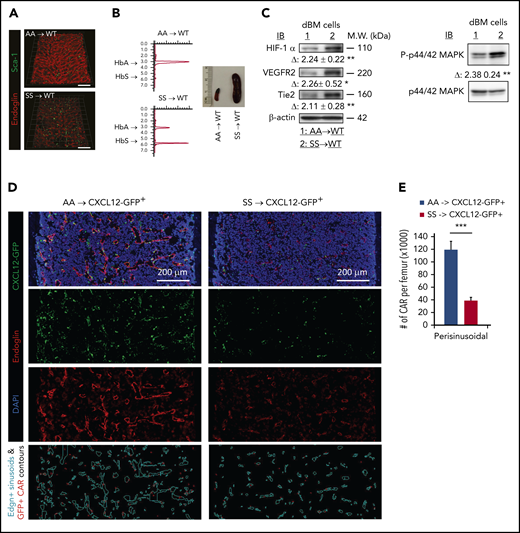 Reconstituted SCD mouse BM cells lead to vascular defects and disrupt the CXCL12+ hematopoietic niche in the BM. Eight-week-old C57BL/6 WT (A-C) or CXCL12-GFP+ healthy (D-E) mice were reconstituted with BM cells (1 × 106 cells per mouse) from AA or SS mice after lethal-dose whole-body irradiation. Four weeks after transplantation, reconstituted SCD mice were euthanized for BM niche analysis. (A) Representative 3D reconstructed confocal images of the femoral diaphysis, as described in Figure 1A. Scale bar = 200 μm. (B) HbS analysis of PB by HPLC (left panels). Spleen images from AA → WT or SS → WT chimera mice (right panel). (C) Hypoxia-induced signaling was analyzed in digested BM (dBM) cells, as described in Figure 3C. Representative blots of 4 independent experiments are shown. Fold change (Δ) in band intensity of proteins and p44/42 MAPK phosphorylation were normalized to β-actin and p44/42 MAPK protein loading, respectively, and shown as mean ± standard error of the mean (SEM) (n = 4; 12 weeks old, 2 female mice and 2 male mice). (D) Representative 2D images of the femoral diaphyses are shown from reconstituted AA → CXCL12-GFP+ or SS → CXCL12-GFP+ healthy mice using LaSC. Femoral sections of 12-week-old chimera mice were stained with endoglin, followed by nuclear DAPI staining. Endoglin+ sinusoidal events and CXCL12-GFPhi CAR events are contoured by iCys LaSC software, as shown in supplemental Figure 5. (E) Quantitative analysis of perisinusoidal CXCL12-GFPhi CAR numbers was performed using iCys LaSC software. Data are mean + SEM (n = 4; 12 weeks old; 2 female mice and 2 male mice). *P < .05, **P < .01, ***P < .001, 2-tailed unpaired Student t test. M.W., molecular weight.