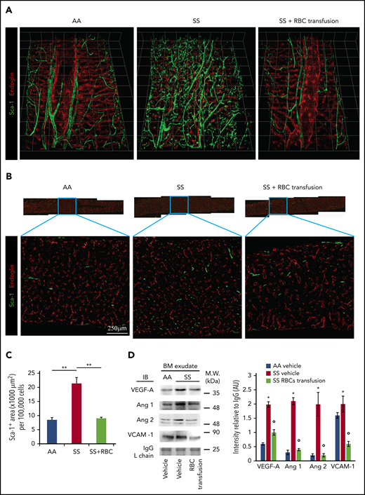 Transfusion of mouse RBCs rescues the vascular defects in SCD mice. (A) BM vasculature structures in transfused mice were analyzed by 3D confocal microscopy after staining femurs with specific antibodies against Sca-1 and endoglin, as described in Figure 1A. Representative images of the femoral diaphyses from 3 independent experiments. Grid scale: 1 unit = 155 μm. (B) Representative 2D images of femoral thin sections stained with specific antibodies against Sca-1 and endoglin by LaSC from 3 independent experiments. (C) LaSC analysis of Sca-1+ area in the BM, plotted as shown in Figure 1C (n = 3; 14-16 weeks old; 1 female mouse and 2 male mice). **P < .01. One-way analysis of variance (ANOVA) with Tukey test for multiple comparisons. (D) Immunoblot (IB) analysis with specific antibodies against VEGF-A, Ang 1, Ang 2, and VCAM-1 of BM exudates from AA mice and SS mice treated with vehicle or RBC transfusion for 6 weeks (left panel). Immunoglobulin G (IgG) light chain (L chain) was used as a loading control. One representative gel of 6 with similar results is shown. Data from densitometric analysis are shown in the bar graph as protein intensity relative to IgG (right panel). Ang 2 represents immature and mature Ang 2 forms. n = 6 from each strain (12-15 weeks old; 3 female mice and 3 male mice). Data are mean ± standard error of the mean. *P < .05 vs AA mice, °P < .05 vs vehicle-treated SS mice, 2-way ANOVA with Bonferroni correction for multiple comparisons. AU, arbitrary units, M.W., molecular weight.
