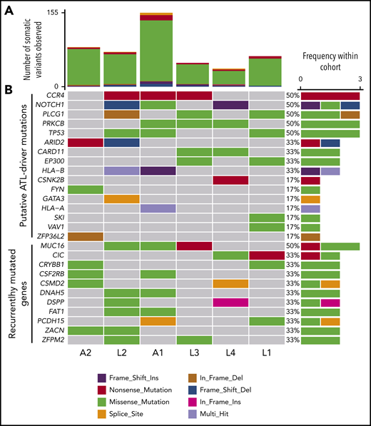 Mutational profile of tumors. (A) Resequenced somatic mutations observed in tumor exome sequencing dataset of 6 patients, A1 to 2, and L1 to 4 classified by type. (B) Frequency and type of probable driver mutations and recurrent mutations. Nonsilent mutations (missense-, nonsense-, and splicing-mutations, and frameshift/in frame insertions/deletions), which occurred in genes that are significantly mutated in ATL,14 were considered putative driver mutations (CCR4 to ZFP36L2). Patient A2 had an additional silent mutation in NOXA1; patient L2 also had silent mutations in TP53 and PIK3CD, and an intronic mutation in POT1. Genes that were recurrently mutated within the cohort were also plotted (MUC16 to ZFPM2).