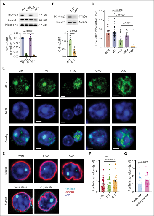 Suv39h DKO lymphocytes show molecular alterations consistent with an aged phenotype. (A) Western blot analysis of H3K9me3 levels from CD45.2+ DP thymocytes (50 000 cells loaded per lane) of different genotypes: Suv39h1-deficient (h1KO), Suv39h2-deficient (h2KO), and DKO. Densitometry data were expressed relative to Lamin B1 (LB1) in that lane and then normalized to WT levels. Mean and SEM together with individual data points are shown. Data were statistically analyzed by 1-way ANOVA with Holm-Sidak multiple comparisons test comparing all genotypes with all others. (B) Western blot analysis of H3K9me3 levels from CD45.2+ DP thymocytes of Suv39h1-deficient and DKO genotypes (400 000 cells loaded per lane). Mean and SEM together with individual data points are shown. Data were statistically analyzed by Student t test. (C) Representative immunofluorescence staining of heterochromatin protein 1-α (HP1α) and colocalization with DAPI bright spots. Scale bar depicts 2 μm. (D) Quantification of colocalization index of thresholded HP1α staining with DAPI bright spots. Data are shown as individual data points together with mean and SEM. Statistical analysis by Kruskal-Wallis H test with Dunn post hoc test. n = 40, 32, 35, 31, 30, respectively, pooled from at least 3 mice of each genotype. (E) Representative immunofluorescence staining of Fibrillarin, Lamin B1, and DAPI from CD45.2+ mouse DP thymocytes and human CD8+ T lymphocytes from cord blood and aged (69 and 74 year old) volunteers (representative of 2 donors of each age). Quantification of fibrillarin spot volume (F-G) shows individual nuclei pooled from all samples together with geometric mean and 95% confidence interval. Data in panel F statistically analyzed by Mann-Whitney U test. Data in panel G statistically analyzed by Kruskal-Wallis H test with Dunn post hoc test. All microscopy images were captured on a Zeiss 880 LSM Laser Scanning Microscope with Airyscan using a 63× Oil Immersion Objective with Numerical Aperture of 1.4.