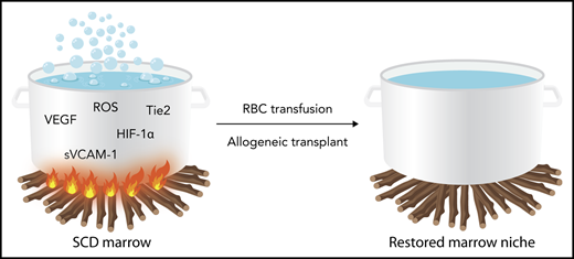 Schematic representation of the disordered bone marrow milieu in sickle cell disease. The inflammatory stimulus represented by fire under the pot is dampened by regular RBC transfusions or allogeneic bone marrow transplantation, which can correct the disordered milieu. HIF-1α, hypoxia inducing factor-1α; RBC, red blood cell; ROS, reactive oxygen species; sVCAM, soluble (circulating) vascular cell adhesion molecule; Tie2, tyrosine kinase with immunoglobulin-like and EGF-like domains 2; VEGF, vascular endothelial growth factor. Professional illustration by Somersault18:24.