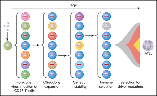 Multihit model for selection of HTLV-1–infected cells to become ATLL cells as a result of multiple intrinsic and extrinsic forces. Virus infection of CD4+ lymphocytes initially results in polyclonal infection (indicated by cells of different color with provirus shown in the nucleus). Expression of HTLV-1 Tax promotes oligoclonal expansion of infected T cells and genetic instability. Immune responses select for T cells with low levels of Tax expression. Driver mutations result in further selection resulting in ATLL in those individuals in which multiple “hits” have occurred to produce a lymphoproliferative malignancy.