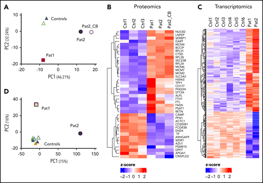 Proteomics and transcriptomic analysis showing differential protein and gene expression between patient and control neutrophils. PCA (A) and heat map (B) of proteome data. Heat map (C) and PCA (D) of transcriptome data. CB, neutrophils isolated from cord blood, Ctrl, control; Pat, patient.