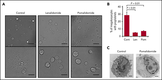 IMiDs inhibit proplatelet formation of human megakaryocytes. (A) Representative phase-contrast microscopic images of megakaryocytes derived from CD34+ HSPCs with or without 10 µM of lenalidomide (Len) or pomalidomide (Pom). Arrows denote megakaryocytes with proplatelets. Lower panels show enlarged images. Images were captured by BZ-X700 (Keyence) with ×20 (upper; scale bars, 50 µm) and ×40 (lower; scale bars, 25 µm) objective lens. (B) Mean percentages of megakaryocytes with proplatelets in 500 cells analyzed per sample. Data are from 3 independent experiments and expressed as means ± standard errors of the mean. P values were determined by 2-tailed Student t test. (C) Transmission electron microscopic images of representative megakaryocytes for each treatment group are shown. Arrowheads denote demarcation membranes. Images were captured by Tecnai F20 electron microscope with ×5000 magnification (scale bar, 1 µm).