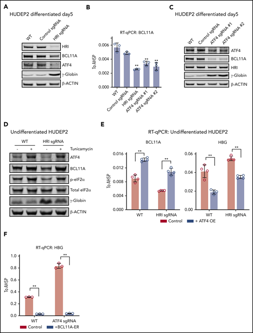 ATF4 links HRI to BCL11A and γ-globin production. (A) Immunoblot analysis of differentiated HUDEP2 after depletion of HRI. (B) BCL11A mRNA levels measured by quantitative reverse transcription polymerase chain reaction (RT-qPCR) in indicated cells. Results are shown as mean ± standard deviation (SD; n = 3). (C) Immunoblot analysis of HUDEP2 upon depletion of ATF4. (D) Immunoblot analysis of undifferentiated HUDEP2 cells treated with 2.5 μg/mL of tunicamycin for 3 days. (E) BCL11A and γ-globin mRNA levels measured by RT-qPCR in parental or ATF4 overexpressing (ATF4 OE) undifferentiated HUDEP2 cells. Results are shown as mean ± SD (n = 4). (F) γ-globin mRNA levels measured by RT-qPCR with overexpression of BCL11A-ER in differentiated HUDEP2 cells. Results are shown as mean ± SD (n = 3). **P < .01 by Student t test. WT, wild type.