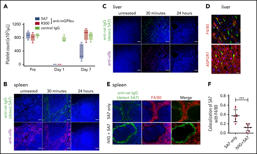 Generation and analysis of an acute platelet-depletion model induced by single high-dose injection of an anti-GPIbα antibody. (A) An anti-GPIbα antibody (5A7 or R300, 2 mg/kg) was administered to C57BL/6J wild-type (WT) mice by retro-orbital injection, and platelet counts were monitored. (B-C) Platelet distribution was visualized by wide-field immunofluorescence analysis of cryosections prepared from spleen (B) and liver (C) harvested from untreated mice or from treated mice 30 minutes or 24 hours after antibody administration (BZ-X700 microscope). Bars represent 100 µm. Tissues were stained with DAPI (blue), anti-rat IgG (green; detecting administered 5A7 antibody), and anti-αIIb antibody (purple). (D) Immunofluorescence staining of cryosectioned liver. Opsonized platelets were stained with anti-rat IgG (green) and macrophages were stained with anti-F4/80 antibody (red). Hepatocytes were stained with anti-ASGPR1 antibody (red; bottom). Images were obtained by confocal microscopy (LSM 880 microscope). Bars represent 20 µm. (E) IVIG was administered via intraperitoneal injection (2 g/kg) 24 hours before 5A7 IV injection (0.6 mg/kg). Spleens harvested 20 minutes after 5A7 administration were cryosectioned and immunostained with anti-rat IgG (green; detecting administered 5A7 antibody) and anti-F4/80 antibody (red), along with costaining with DAPI (blue). (F) Images were binarized, and colocalization of opsonized platelets (stained by anti-rat IgG) with F4/80 was calculated as a ratio by quantifying anti-rat IgG and F4/80 costained area divided by total of anti-rat IgG–stained area, by using Fiji image-analysis software. ***P < .001 by unpaired Student t test.