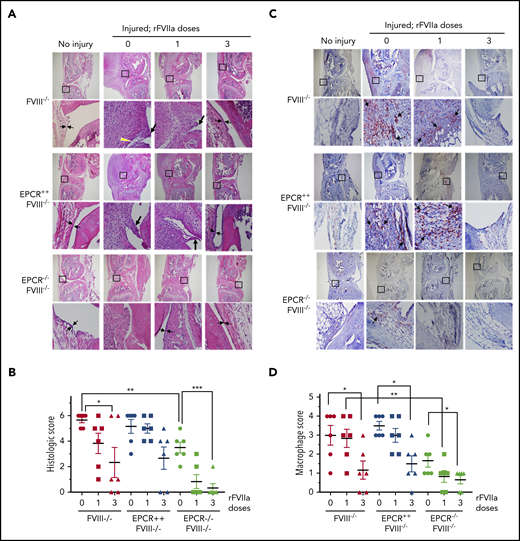 Histopathological analysis and evaluation of macrophage infiltration in knee joints of FVIII−/− , EPCR++ FVIII−/− , and EPCR−/− FVIII−/− mice 2 weeks after needle injury. Joint bleeding in FVIII−/−, EPCR++FVIII−/−, and EPCR−/−FVIII−/− mice was induced by needle puncture of joint. The mice were left either untreated (0) or treated with a single dose or 3 doses of rFVIIa, as described in the Figure 1 legend. Fourteen days after injury, knee joints were excised and sectioned, and tissue sections were stained with H&E (A) or the macrophage marker F4/80 (C). As a control, knee joint tissue sections of uninjured mice were also stained. The original magnification of images shown in the top lane is ×4. The area identified in the square box was reimaged at higher magnification (×40) and shown in the bottom lane. The histology of uninjured knee joints exhibits distal femur and proximal tibia, synovium with ≤4 cell layers of the synovial lining, and subsynovial cells associated with fat cells in the synovium with the meniscus in the center. (A) Two thin black arrows pointing each other indicate width of synovial lining layer, the yellow arrowhead points out red blood cells, and the thick black arrows point out synovial villi. (C) Arrows point out macrophages. (B) The joint tissue pathology was quantified by scoring H&E-stained sections on a 0 to 6 scale for synovial hyperplasia (0, normal, less than 4 cell layers thick; 1, 4-5 layers thick 1; 6-7 layers thick; 3, >7 layers), presence of red blood cells (0, absent; 1, present), villus formation (0, absent; 1, present), and discoloration by hemosiderin (0, absent; 1, present). (D) Macrophage infiltration was quantified on a 0 to 4 scale (0, absence of macrophages; 1, scattered macrophages; 2, line of macrophages; 3, a cluster of macrophages; 4, sheets of macrophages). *P < .05; **P < .01; ***P < .001.