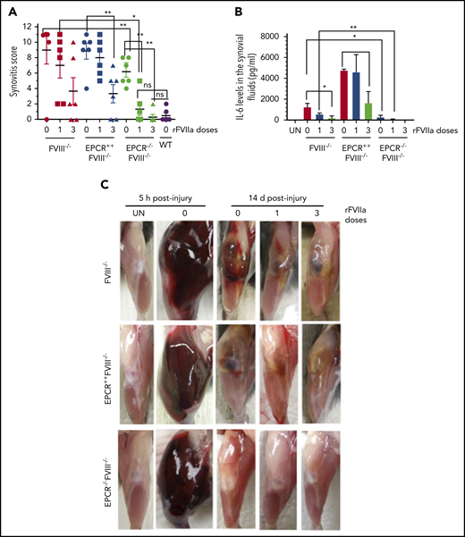 EPCR deficiency attenuates synovitis following hemarthrosis in FVIII−/− mouse joint. Joint bleeding in WT, FVIII−/−, EPCR++FVIII−/−, and EPCR−/−FVIII−/− mice was induced by needle injury, and the mice were treated with a single or 3 doses of rFVIIa or left untreated as described in the Figure 1 legend. (A) Synovitis score was determined as described in "Materials and methods," and a score of 11 was maximum. (B) IL-6 levels in synovial fluids. (C) Representative images of uninjured and injured knees. *P < .05; **P < .01; ns, no statistically significant difference.
