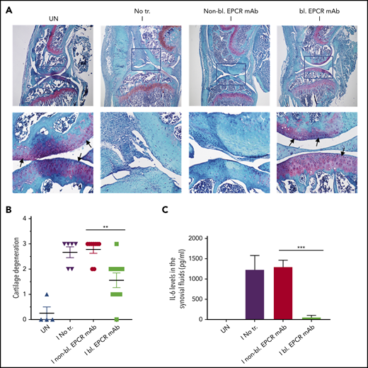 EPCR blocking prevents the degeneration of cartilage and elaboration of IL-6 in the synovium of FVIII−/− mice following hemarthrosis. FVIII−/− mice were administered with EPCR-blocking mAb (bl. EPCR mAb), EPCR-nonblocking mAb (non-bl. EPCR mAb), or no mAb (No tr.). Twenty-four hours later, joint bleeding was induced with a needle puncture (I). UN indicates an uninjured knee. (A) Two weeks after the injury, mice were killed, knee joints were excised, and joint tissue sections were stained with Safranin O/Fast Green Staining. Top panel images were captured at 4 magnification. The squared area was imaged at ×40 magnification (bottom panel). Arrows point out the articular cartilage. Loss of red stain in the articular cartilage region indicates the loss of glycosaminoglycans in the region and cartilage degeneration. (B) The quantified score of cartilage degeneration based on Safranin O/Fast Green Staining (0-3 scale; 0, normal/bright red staining of cartilage; 1, a slight reduction in staining; 2, a moderate reduction in staining; and 3, severe reduction/complete loss of staining). (C) One week after the injury, mice were killed, and synovial fluids were collected. IL-6 levels in synovial fluids were measured in enzyme-linked immunosorbent assay. The data shown are mean ± SEM (n = 4-7 mice/group). ***P < .001