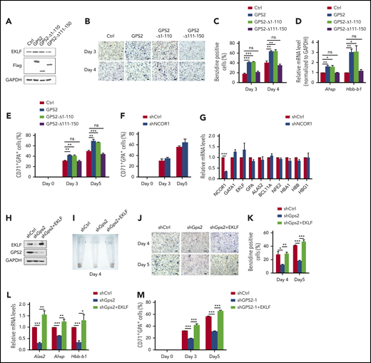 GPS2 promotes erythroid cell differentiation depending on EKLF. (A-D) Control cells and MEL cells with stable overexpression of WT GPS2 or GPS2 deletion mutants were left untreated or treated with HMBA for indicated times. Immunoblot analysis of GPS2 and EKLF protein levels (A). Hemoglobin production was analyzed by benzidine staining at days 3 and 4. Representative images of benzidine-stained cells are shown; scale bar, 20 μm (B). The percentage of benzidine-positive cells was calculated (C). Real-time PCR analysis of Ahsp and Hbb-b1 mRNA levels at day 3 (D). (E) CD34+GFP+ cells were selected from human UCB CD34+ cells infected with lentivirus expressing WT GPS2 or GPS2 deletion mutants and cultured in the erythroid differentiation medium for the indicated times. The proportion of CD71+GPA+ cells at days 0, 3, and 5 was analyzed by flow cytometry. (F-G) Human UCB CD34+ cells infected with NCOR1 or control shRNA lentivirus were cultured in the erythroid differentiation medium for the indicated times. The proportion of CD71+GPA+ cells at days 0, 3, and 5 was analyzed by flow cytometry (F). mRNA levels of the indicated erythroid genes in FACS-isolated CD71+GPA+ cells at day 3 were analyzed with real-time PCR (G). (H-L) Control cells and MEL cells with stable GPS2 knockdown or GPS2 knockdown and EKLF overexpression were left untreated or treated with HMBA for the indicated times. EKLF and GPS2 protein levels were analyzed by western blot (H). A representative photograph of the color of cell pellets at day 4 (I). Hemoglobin production was analyzed by benzidine staining at days 4 and 5. Representative images of benzidine-stained cells are shown; scale bar, 20 μm (J). The percentage of benzidine-positive cells was calculated (K). Relative mRNA levels of Alas2, Ahsp, and Hbb-b1 at day 3 were analyzed by real-time PCR (L). (M) CD34+GFP+RFP+ cells were selected from human UCB CD34+ cells infected with GPS2 shRNA lentivirus and EKLF overexpression or control lentivirus and then cultured in erythroid differentiation medium for the indicated times. The proportion of CD71+GPA+ cells at day 0, 3, and 5 was analyzed by flow cytometry. All values are mean ± SEM (n = 3 replicates). *P < .05, **P < .01, ***P < .001; 2-tailed unpaired t test.