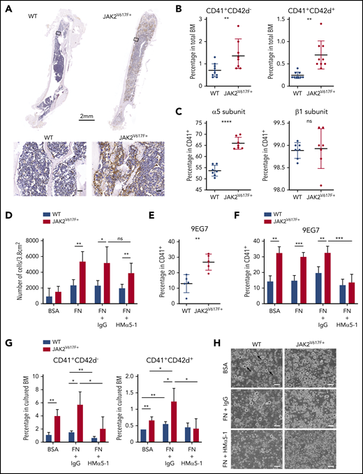 Increased expression of α5 subunit and adhesion of JAK2V617F+ megakaryocytes to fibronectin results in megakaryocytosis. (A) Immunohistochemical staining of fibronectin (brown) in BM of C57BL/6J WT and JAK2V617F+ mice (26-week-old males). Top: whole-bone scanning (×0.4 original magnification). Inset squares: approximate location of images shown in bottom panels (×20 original magnification; scale bars represent 50 μm). (B) Percentage of CD41+CD42d− and CD41+CD42d+ megakaryocytes in BM of WT (n = 6 females and 4 males, 15 weeks old) and JAK2V617F+ mice (n = 5 females and 4 males, 15 weeks old). The differential effect persisted in the 2 sexes. (C) Cell surface expression of α5 (HMα5-1 antibody) and β1 (Ha2/5 antibody) subunits on CD41+ megakaryocytes differentiated in vitro. Data represent 2 independent experiments from WT (n = 4, 21-week-old males and n = 3, 18-week-old females) and JAK2V617F+ mice (n = 3, 21-week-old males and n = 4, 18-week-old females). Note that y-axis does not start at 0. (D) Adhesion assay of in vitro-differentiated megakaryocytes on plates coated with control BSA or FN, treated with an inhibitory antibody against α5 subunit (HMα5-1) or with a hamster IgG isotype control. Data represent 2 independent experiments, from WT (n = 2, 13-week-old and n = 2, 21-week-old males) and JAK2V617F+ mice (n = 4, 13-week-old and n = 3, 21-week-old males). (E) Cell surface expression of extended conformation β1 subunit (9EG7 antibody) in CD41+ megakaryocytes differentiated in vitro from WT and JAK2V617F+ mice (n = 5 each, 14-week-old males). (F) Similar analysis as in panel E, with megakaryocytes treated with an inhibitory antibody against α5 subunit (HMα5-1) or with a hamster IgG isotype control during in vitro differentiation on BSA or FN-coated plates. Data represent WT (n = 4, 18-week-old females) and JAK2V617F+ mice (n = 3, 18-week-old females). (G) Percentage of CD41+CD42d− and CD41+CD42d+ megakaryocytes in BM cultured under conditions as in panel F. Representative data from 1 of 2 independent experiments showing similar tendency are shown, from WT (n = 3, 10-week-old females) and JAK2V617F+ (n = 4, 10-week-old females). (H) Representative bright-field images of megakaryocytes differentiated in vitro in culture conditions shown in panel G. Arrows indicate some examples of megakaryocytes (×10 original magnification; scale bars represent 100 μm). Data are expressed as mean ± standard deviation; ns, not significant. *P < .05, **P < .01, ***P < .001, ****P < .0001.