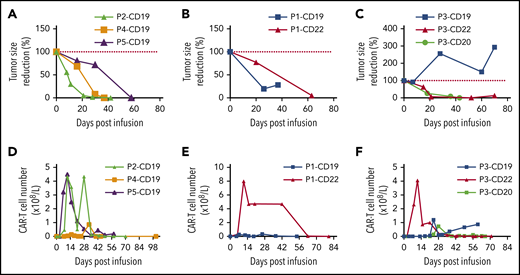 Tumor response and CAR-T cell expansion after infusion. (A) Tumor volume change (relative to tumor volume at day 0) for patients 2, 4, and 5. (B) Tumor volume change (relative to tumor volume at day 0) for patient 1 treated with CD19 and CD22 directed CAR-T cell therapy. (C) Tumor volume change (relative to tumor volume at day 0) for patient 3 treated with CD19, CD22, and CD20 directed CAR-T cell therapy. (D) CAR-T cells absolute number change for patients 2, 4, and 5. (E) CAR-T cells absolute number change for patient 1 treated with CD19 and CD22 directed CAR-T cell therapy. (F) CAR-T cells absolute number change for patient 3 treated with CD19, CD22, and CD20 directed CAR-T cell therapy. Single major tumor volume was measured by computed tomography or B-ultrasound.