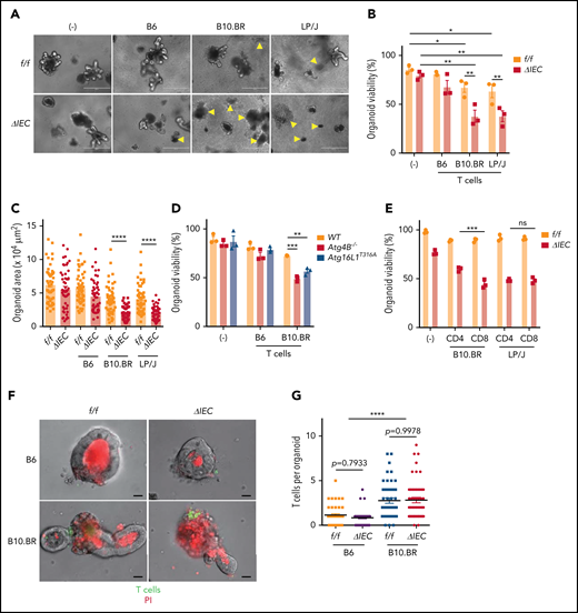 Allogeneic T cells induce cell death in intestinal organoids with autophagy gene mutations. Representative images (A), viability (B), and size (C) of small intestinal organoids from B6-background Atg16L1f/f (f/f) and Atg16L1ΔIEC (ΔIEC) mice cocultured for 48 hours with 1 × 105 splenic T cells separately harvested from B6, B10.BR, and LP/J mice. n = 3 mice each. Arrowheads indicate dead organoids. Scale bars, 400 µm. (D) Viability of organoids from B6-background Atg4B−/− and Atg16L1T316A mice cocultured for 48 hours with 1 × 105 splenic T cells separately harvested from B10.BR mice; n = 3 mice each. (E) Viability of small intestinal organoids from f/f and ΔIEC mice cocultured for 48 hours with FACS-sorted 1 × 105 CD4+ or 7 × 104 CD8+ T cells from B10.BR and LP/J mice; n = 3 mice each. Representative images (F) and number of T cells associated with organoid (G). At least 50 organoids were analyzed per group. T cells were stained with CellBrite Green (green) before coculture, and propidium iodide (PI; red) was added to the culture medium at the beginning to stain dead organoids/T cells. Scale bars, 25 µm; n = 3 mice each. Data points in B, D, and E are mean of technical replicates, and data points in C and F represent individual organoids. Bars represent mean ± standard error of the mean, and ≥2 independent experiments were performed. *P < .05, **P < .01, ***P < .001, ****P < .0001. ns, not significant; WT, wild-type.