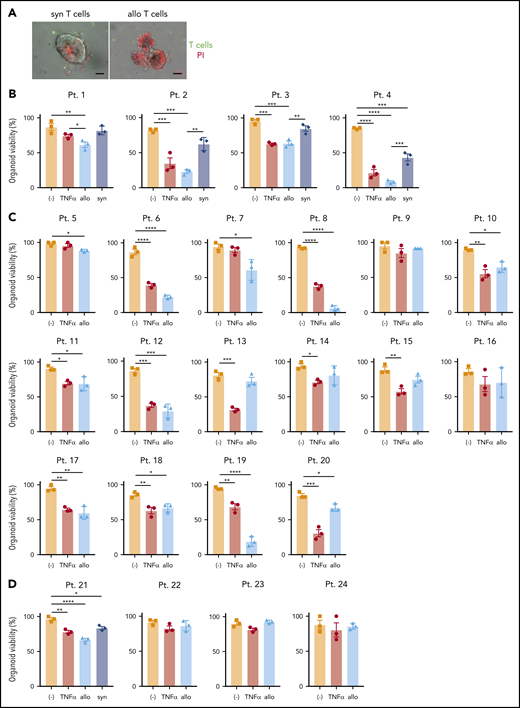 Development of an ex vivo intestinal GVHD model using human intestinal organoids and peripheral T cells. (A) Representative images of human small intestinal organoids cocultured for 8 hours with syngeneic (syn) or allogeneic (allo) human T cells. Sorted T cells were stained with CellBrite Green (green) before coculture, and PI (red) was added into the culture medium at the beginning to stain dead organoids. Scale bars, 25 µm. Viability of human small intestinal organoids from 20 patients (supplemental Table 3) at 48 hours after stimulation with 50 ng/mL TNF-α or post coculture with allogeneic and syngeneic T cells (B) or with only allogeneic T cells (C). (D) Viability of human colonic organoids from 4 patients (supplemental Table 2) at 48 hours after stimulation with 50 ng/mL TNF-α or post coculture with allogeneic and/or syngeneic T cells. At least 2 independent experiments were performed. *P < .05, **P < .01, ***P < .001, ****P < .0001. Pt., patient.