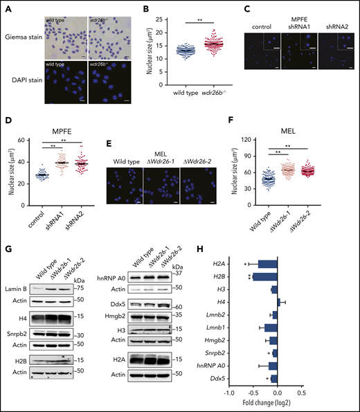 Deficiency of Wdr26 leads to enlarged nuclei with elevated protein abundance in differentiating erythroblasts. (A) Giemsa and DAPI staining of wild-type and wdr26b−/− zebrafish blood cells. Scale bars, 10 μm (Giemsa) and 5 μm (DAPI). (B) Quantification of nuclear size of zebrafish blood cells in panel A. Three pairs of wild-type and wdr26b−/− fish were analyzed. At least 100 cells were quantified for each genotype. **P < .01. (C) DAPI staining showed enlarged nuclei in Wdr26-silencing mouse primary erythroblasts. Scale bars, 20 μm. DAPI, 4′,6-diamidino-2-phenylindole; MPFE, mouse primary fetal liver erythroblast. (D) Quantitative analysis of the nuclear size of control and Wdr26-silencing mouse primary erythroblasts. More than 50 cells are shown for each shRNA. (E) DAPI staining showed enlarged nuclei in chemically induced Wdr26-knockout MEL cells. Scale bars, 10 μm. (F) Quantification of nuclear size in panel E. At least 100 cells were quantified for each clone. (G) Western analysis of nuclear proteins in DMSO-induced wild-type and Wdr26-knockout MEL cells. (H) mRNA expression of genes encoding the nuclear proteins shown in panel G. Error bars represent SEM from 2 replicates in an RNA-seq experiment. *P < .05, **P < .01.