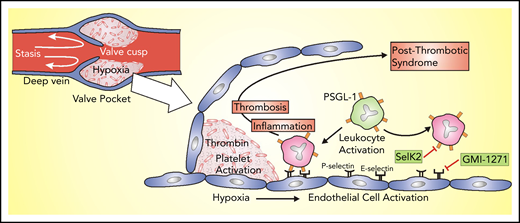 Modulating the cellular inflammatory response to prevent thrombosis and PTS. Most venous thrombi originate in the valve pockets when endothelial cells activated by stasis and resultant hypoxia express adhesion molecules, such as P- and E-selectin, on their surface. Leukocytes express PSGL-1 on their surface, which tethers them to the P- or E-selectin on activated endothelial cells. Tethered leukocytes express tissue factor, which initiates coagulation, and release proinflammatory cytokines. Together, these factors promote thrombosis and inflammation, which can lead to PTS. SelK2 and GMI-1271 have the potential to block this process by inhibiting PSGL-1 and E-selectin, respectively.