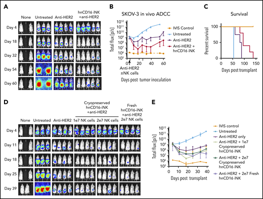hnCD16-iNK cells mediate improved ADCC in vivo against ovarian cancer. NSG mice were inoculated intraperitoneally with 1 × 105 Luc-expressing SKOV-3 cells, and tumor engraftment was assessed by IVIS imaging 4 days later. On day 5 after tumor transplant, mice were left untreated or were treated with 100 μg of anti-HER2 alone or in combination with 5 × 106 hnCD16 iNK cells. NK cells were supported by twice weekly injections of IL-2, and IVIS imaging was done weekly to track tumor load. (A) IVIS imaging. (B) Quantification of geometric mean ± standard deviation for the mice in panel A. (C) Kaplan-Meier curve representing the percent survival of the experimental groups. Untreated vs anti-HER2, P = .0140; anti-HER2 vs anti-HER2 + hnCD16 iNK+, P = .004; 2-tailed log-rank test. (D) Mice injected with Luc-expressing SKOV-3 cells were treated with 1 × 107 (1e7) or 2 × 107 (2e7) cryopreserved hnCD16-iNK cells or with 2 × 107 fresh hnCD16-iNK cells + anti-HER2 antibody. (D) IVIS imaging. (E) Quantification of the geometric mean ± standard deviation for the mice in panel D.