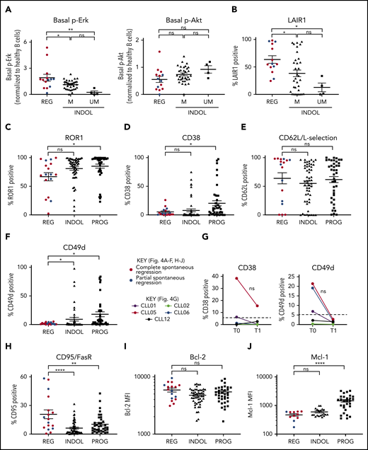 Spontaneously regressed CLL tumors express weak surface CD49d but retain high levels of Bcl-2. FACS analysis of the gated CLL population of PBMCs. The gated CLL population was analyzed for (A) basal Erk and Akt phosphorylation and (B) cell-surface LAIR1 expression. Spontaneous regression cases (REG; n = 14) from the regression time point (T1) were compared against indolent (INDOL) M-CLL (n = 35) and UM-CLL (n = 4) cases. Basal Erk and Akt phosphorylation in CLL cells was normalized to B cells from 3 age-matched healthy donors, and expressed as fold change compared with these controls. CLL expression of (C) ROR1, (D) CD38, (E) CD62L, and (F) CD49d on spontaneous regression cases (REG, n = 17) from the regression time point (T1) compared with indolent (INDOL; n = 54) and progressive (PROG; n = 40) cases. (G) Expression of CD49d and CD38 was compared between sequential diagnostic (T0) and regression (T1) time points in individual spontaneous regression cases. The gated CLL population was analyzed for the expression of (H) FasR, (I) Bcl-2, and (J) Mcl-1. For all comparisons except Mcl-1, 17 spontaneous regression cases (REG) from the regression time point (T1) were compared against 54 indolent (INDOL) and 40 progressive (PROG) CLL cases. For Mcl-1, 11 spontaneous regression cases from the regression time point (T1) were compared against 20 indolent and 29 progressive cases. In panels A to F and H to J, complete and partial spontaneous regression are represented by red and blue dots, respectively. Statistical significance is indicated by *P < .05, **P < .01, ***P < .001, and ****P < .0001. In panel G, each colored line represents a specific case and 5% expression is indicated (- - -). ns, comparisons that are not statistically significant.