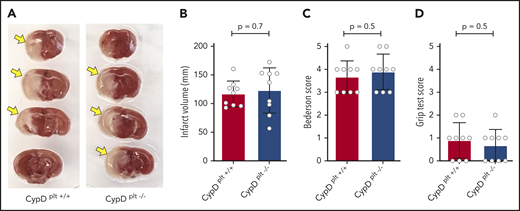 During permanent ischemic stroke, platelet CypD does not regulate infarct size or neurological and motor outcomes. Male and female CypDplt−/− mice or littermate controls (CypDplt+/+) were subjected to permanent (eg, 24 hours) cerebral ischemia (eg, pMCAO). (A) Representative brain sections stained with 2,3,5-triphenyl tetrazolium chloride. Healthy tissue stains red, whereas an absence of staining (white; arrows) indicates infarcted area. (B) Brain infarct volumes were quantified by planimetric analysis. (C) Neurological outcome was assessed using the Bederson test. (D) Motor function was examined using the grip strength test.