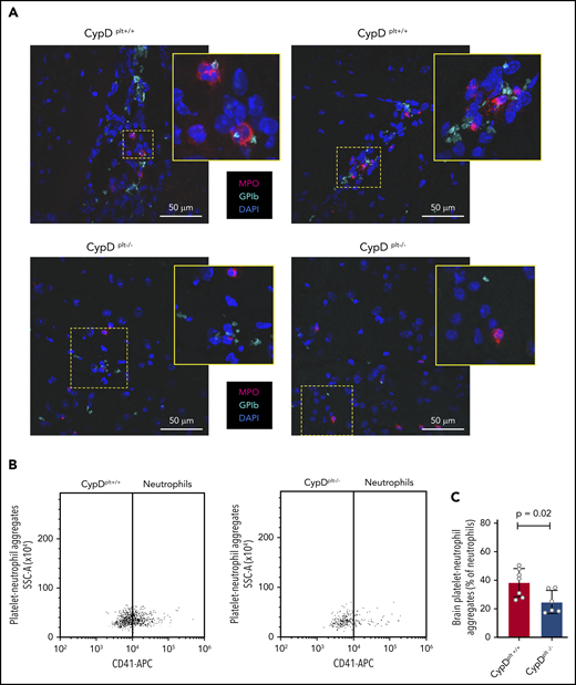 Platelet CypD mediates PNA accumulation in brain tissue following cerebral ischemia-reperfusion injury. Male and female CypDplt−/− mice or littermate controls (CypDplt+/+) were subjected to 1 hour of cerebral ischemia followed by 23 hours of reperfusion (tMCAO). (A) Representative images of platelet-neutrophil complexes, as costained by GPIb (platelet, green) and myeloperoxidase (neutrophils, red), in ischemic brain tissue 24 hours after stroke. Blue staining shows nuclei (DAPI). The boxed areas in each panel are shown enlarged (insets). (B) Representative dot plots of flow cytometric analysis of PNAs in brain tissue. (C) Quantification of the number of PNAs in the ischemic hemisphere analyzed by flow cytometry 24 hours after stroke.